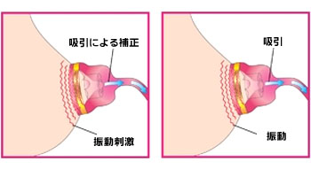 �זv����̔Y�݂Ƀh���[���`���[���A�W���X�g